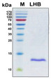 LHB / Luteinizing Hormone Protein - SDS-PAGE under reducing conditions and visualized by Coomassie blue staining