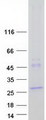 LHFPL2 Protein - Purified recombinant protein LHFPL2 was analyzed by SDS-PAGE gel and Coomassie Blue Staining