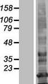 LHFPL3 Protein - Western validation with an anti-DDK antibody * L: Control HEK293 lysate R: Over-expression lysate