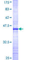 LHX5 Protein - 12.5% SDS-PAGE Stained with Coomassie Blue.