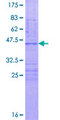 LIAS / LIP1 Protein - 12.5% SDS-PAGE of human LIAS stained with Coomassie Blue