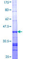 LIAS / LIP1 Protein - 12.5% SDS-PAGE Stained with Coomassie Blue.