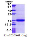 LIMD2 Protein