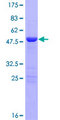 LIN7B Protein - 12.5% SDS-PAGE of human LIN7B stained with Coomassie Blue