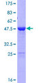 LIN7C / VELI3 Protein - 12.5% SDS-PAGE of human LIN7C stained with Coomassie Blue