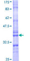 LINC01587 Protein