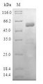 LIPA / Lysosomal Acid Lipase Protein - (Tris-Glycine gel) Discontinuous SDS-PAGE (reduced) with 5% enrichment gel and 15% separation gel.