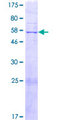 LMNTD1 / IFLTD1 Protein - 12.5% SDS-PAGE of human IFLTD1 stained with Coomassie Blue