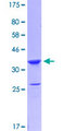 LMO4 Protein - 12.5% SDS-PAGE Stained with Coomassie Blue.