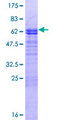 LMOD3 Protein - 12.5% SDS-PAGE of human LMOD3 stained with Coomassie Blue