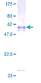 LMPB1 / PAQR8 Protein - 12.5% SDS-PAGE of human C6orf33 stained with Coomassie Blue