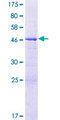 LOH12CR1 Protein - 12.5% SDS-PAGE of human LOH12CR1 stained with Coomassie Blue