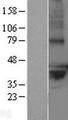 LPPR2 Protein - Western validation with an anti-DDK antibody * L: Control HEK293 lysate R: Over-expression lysate