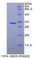 LRP5L Protein - Recombinant Low Density Lipoprotein Receptor Related Protein 5 Like Protein By SDS-PAGE