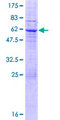 LRRC10 Protein - 12.5% SDS-PAGE of human LRRC10 stained with Coomassie Blue