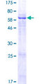 LRRC28 Protein - 12.5% SDS-PAGE of human LRRC28 stained with Coomassie Blue