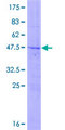 LRRC29 Protein - 12.5% SDS-PAGE of human LRRC29 stained with Coomassie Blue