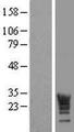 LRRC61 Protein - Western validation with an anti-DDK antibody * L: Control HEK293 lysate R: Over-expression lysate