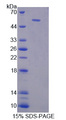 LRRN1 Protein - Recombinant Leucine Rich Repeat Neuronal Protein 1 By SDS-PAGE