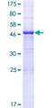 LRRN4CL Protein - 12.5% SDS-PAGE of human LOC221091 stained with Coomassie Blue