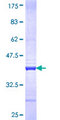 LSM2 / SnRNP Protein - 12.5% SDS-PAGE Stained with Coomassie Blue.