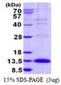 LSM2 / SnRNP Protein