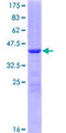 LSM4 Protein - 12.5% SDS-PAGE of human LSM4 stained with Coomassie Blue