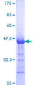 LTBP2 Protein - 12.5% SDS-PAGE Stained with Coomassie Blue.
