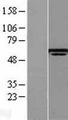 LTV1 Protein - Western validation with an anti-DDK antibody * L: Control HEK293 lysate R: Over-expression lysate