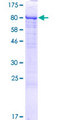 LTV1 Protein - 12.5% SDS-PAGE of human LTV1 stained with Coomassie Blue