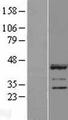 LUZP2 Protein - Western validation with an anti-DDK antibody * L: Control HEK293 lysate R: Over-expression lysate