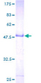 LYPD5 Protein - 12.5% SDS-PAGE of human LYPD5 stained with Coomassie Blue