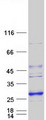 LYPLAL1 Protein - Purified recombinant protein LYPLAL1 was analyzed by SDS-PAGE gel and Coomassie Blue Staining