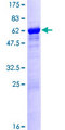 LZTFL1 Protein - 12.5% SDS-PAGE of human LZTFL1 stained with Coomassie Blue
