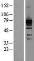 LZTS1 Protein - Western validation with an anti-DDK antibody * L: Control HEK293 lysate R: Over-expression lysate