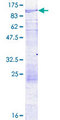 LZTS3 Protein - 12.5% SDS-PAGE of human ProSAPiP1 stained with Coomassie Blue