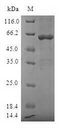 M-PST / STM Protein - (Tris-Glycine gel) Discontinuous SDS-PAGE (reduced) with 5% enrichment gel and 15% separation gel.