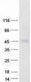 MACROD2 Protein - Purified recombinant protein MACROD2 was analyzed by SDS-PAGE gel and Coomassie Blue Staining