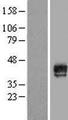 MAGEB18 Protein - Western validation with an anti-DDK antibody * L: Control HEK293 lysate R: Over-expression lysate
