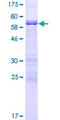 MAGEB4 Protein - 12.5% SDS-PAGE of human MAGEB4 stained with Coomassie Blue