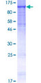MANBA Protein - 12.5% SDS-PAGE of human MANBA stained with Coomassie Blue