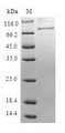 Mannose Phosphate Isomerase Protein - (Tris-Glycine gel) Discontinuous SDS-PAGE (reduced) with 5% enrichment gel and 15% separation gel.