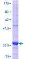 MAP3K3 / MEKK3 Protein - 12.5% SDS-PAGE Stained with Coomassie Blue.