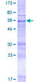 MBOAT1 Protein - 12.5% SDS-PAGE of human MBOAT1 stained with Coomassie Blue