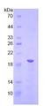 MBOAT5 / C3F Protein - Recombinant Lysophosphatidylcholine Acyltransferase 3 By SDS-PAGE