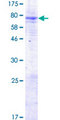 MBOAT7 / BB1 Protein - 12.5% SDS-PAGE of human LENG4 stained with Coomassie Blue