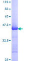 MCM3 Protein - 12.5% SDS-PAGE Stained with Coomassie Blue.