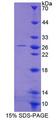MCM3 Protein - Recombinant Minichromosome Maintenance Deficient 3 (MCM3) by SDS-PAGE