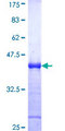 MCPH1 Protein - 12.5% SDS-PAGE Stained with Coomassie Blue.