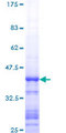 MDM2 Protein - 12.5% SDS-PAGE Stained with Coomassie Blue.
